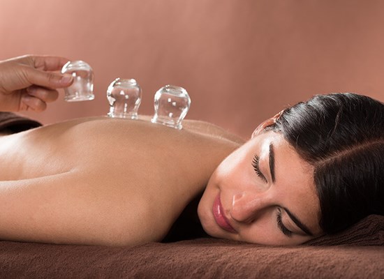 Fire Cupping Fire Cupping